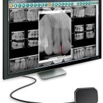 advanced computerized x-ray imaging system